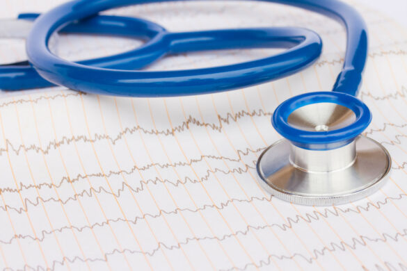 A stethoscope